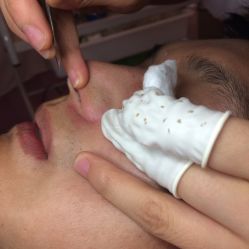 -成都苗方清颜专业祛痘