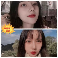 -素美医疗美容·西南眼鼻整形·修复基地