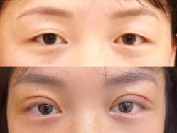 -Yestar 嘉兴艺星医疗美容医院