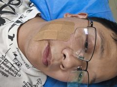 -杭州仁易堂中医康复医院疤痕修复