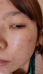 体验前-坤如玛丽·医疗美容中心