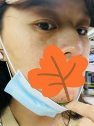 体验后-上海首尔丽格医疗美容医院