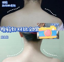 -上海漾颜医疗美容