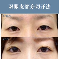 -丽都整形美容医院·全国连锁旗舰店