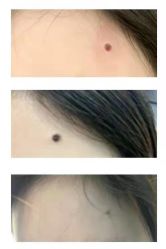 -成都军建医院·疤痕诊疗中心