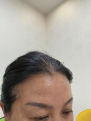 -长沙雅美医疗美容医院