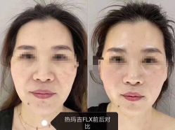 -西施无菌半永久纹绣眉眼影唇轻增发纹发际线