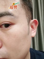 体验后-新美荟医美·专注面部美学抗衰