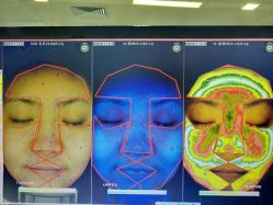 皮肤检测-光SPA科技美肤