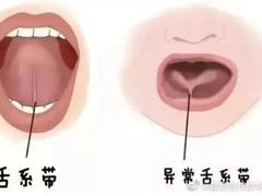-惠耳听力助听器(霍邱新蓼大道店)