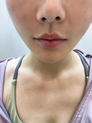 -深圳艺星医疗美容医院
