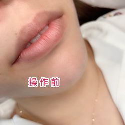 -西施无菌半永久纹绣眉眼影唇轻增发纹发际线