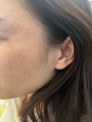 -长沙雅美医疗美容医院