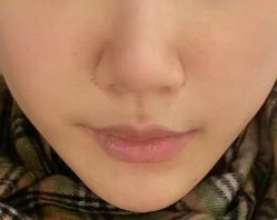 -郡艺医疗美容·微整·眼鼻吸脂