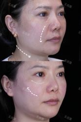-Yestar重庆艺星医疗美容医院