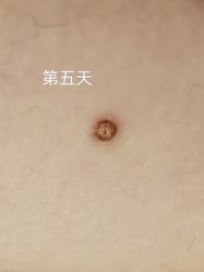 体验后-青岛诺德医学美容医院