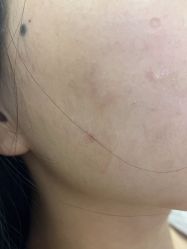 点击看大图 体验后-重庆联合丽格第五医疗美容医院
