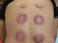 -中医推拿(永兴佳园店)