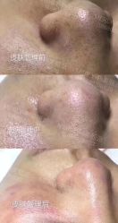 -MLP美丽派·问题肌疗愈中心