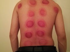 -初心正骨艾灸养生馆