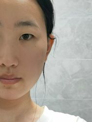 -铂特丽医美·眼鼻整形·光电美肤·注射抗衰