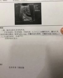 -武汉玛丽亚月子中心