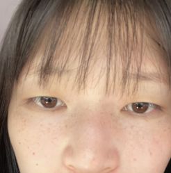 -Yestar重庆艺星医疗美容医院