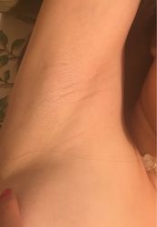 -咪咪比基尼脱毛专业店