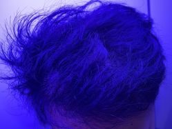 -熙朵美学植发·连锁品牌