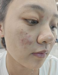 -苗医生专业祛痘·皮肤管理