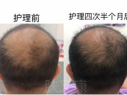 -天其美科学美肤·生发健康管理