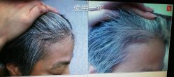 -博士园养发馆