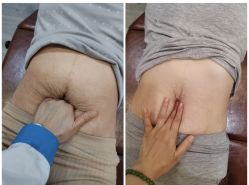 -Fundi张玉珊修身堂·indiba·BTL科技瘦身