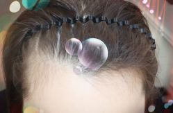 -大麦微针植发全国连锁