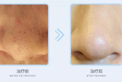 -Cream88颜皮肤管理中心