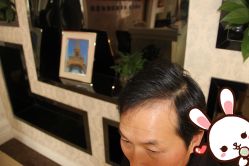 点击看大图 -大麦微针植发丨全国连锁