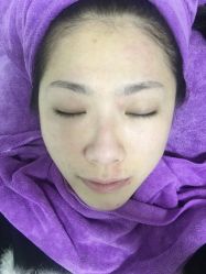 -蕾特恩专业祛痘国际连锁