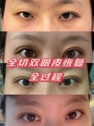 -上海漾颜医疗美容