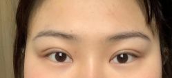 -素美医疗美容·西南眼鼻整形·修复基地