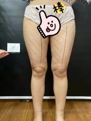 -洁铭新加坡医美