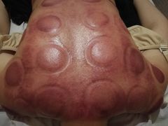 -益友堂盲人推拿正骨穴位按摩工作室