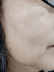 -露德瑪麗科技美肤·美迪迈·华熙生物
