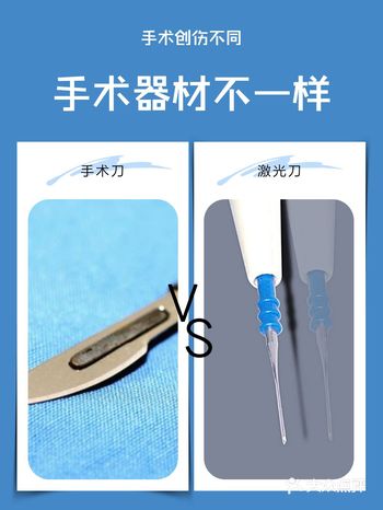 都是割双眼皮，为什么你的眼睛一直不消肿?