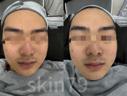 -SKIN79皮肤管理中心