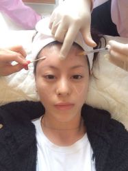 iphone_upload_pic-芷妍医美