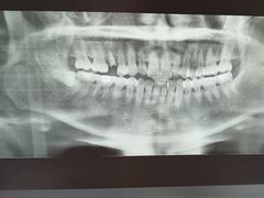 -土豆口腔(凤凰北总店)