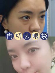-天津健丽·去眼袋医疗美容机构
