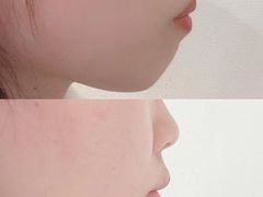 -极光口腔·矫正种植修复(锦江店)