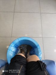 -德哥灰指甲脚气甲沟炎跖疣护理