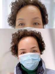 -Doris多里斯半永久纹眉·SMP纹发·发际线